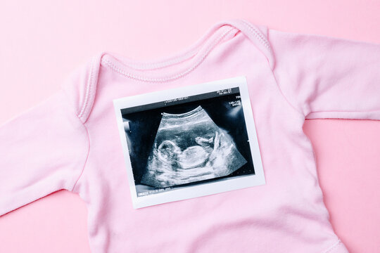 Ultrasound picture pregnant baby photo. Fashion cute baby cloth with ultrasound pregnancy image on pink background. Pregnancy, medicine, pharmaceutics, health care and people concept.