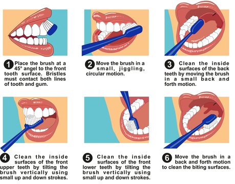 Steps of how to brush your teeth infographic diagram human mouth tooth surface clean inside gum forth motion using toothpaste vector illustration drawing for medical dental clinic education poster