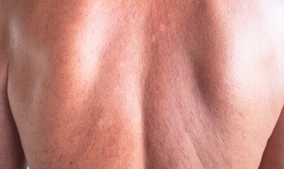 Problem skin rash from allergy symptoms..
