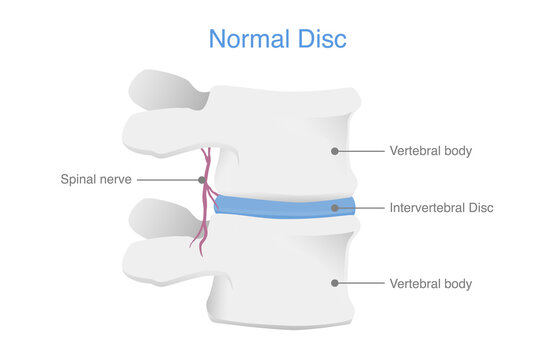 Anatomy of normal human Disc. Illustration of Medical diagram about the spine in top view for check disc herniation. nucleus pulposus, annulus fibrosis.