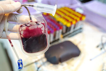 Blood donor at donation, transfusion. Blood donation.