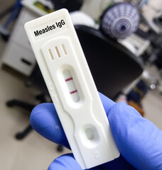 Lab Technologist hold a device of Measles IgG rapid screening test, showing IgM positive results.