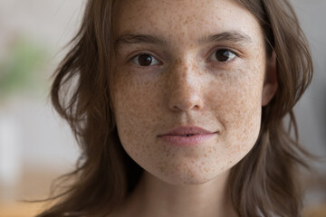 Serious freckled girl facial close up portrait. Pretty beautiful young woman clean face without...