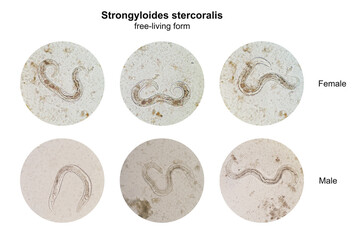 Microscopic view collage of free-living form male and female Strongyloides stercoralis in human...