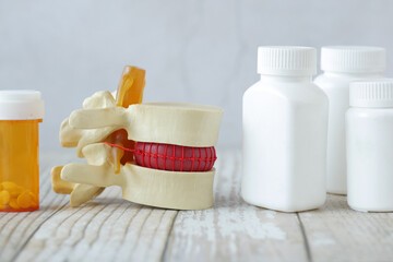 sample of Spinal cord on clinic desk 