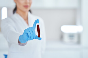 Woman holding test tube with blood and mixing machine