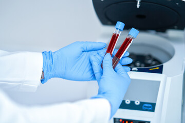 Test tube with blood and mixing machine