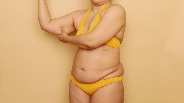 Side view of unrecognizable plump woman wearing yellow bra, bikini, squeezing excess flabby fat of arm, stretching, slapping on beige background. Body positive, weight loss, liposuction, massaging.