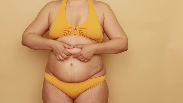 Unrecognizable plump woman standing in yellow bra, bikini, massaging excess belly with fingers, lifting for better soaking cream on beige background. Anticellulite homemade treatment, skin, body care.