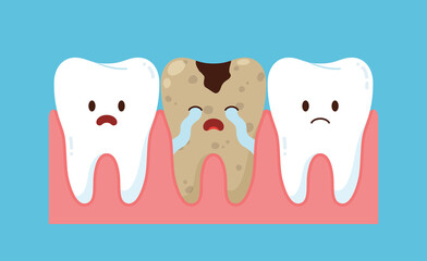 Cute tooth with dental plaque and healthy ones set, flat vector isolated.
