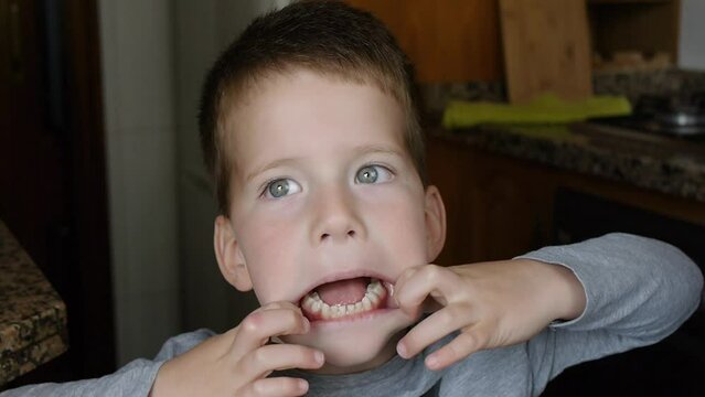 Close-up of funny kid making faces. The boy stretches his mouth, showing crooked teeth