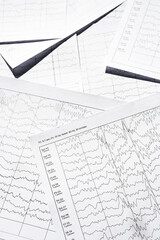 Electroencephalogram diagnostic rezults after epilepsy. Brain wave patterns on EEG.