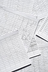 Electroencephalogram diagnostic rezults after epilepsy. Brain wave patterns on EEG.