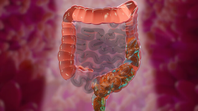 3d illustration of human digestive system anatomy, concept of the intestine,  laxative, traitement of constipation, 3d render
