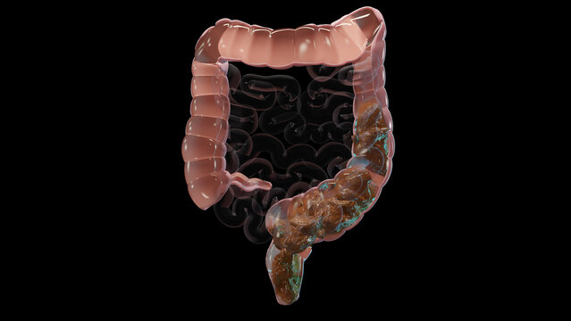 3d illustration of human digestive system anatomy, concept of the intestine,  laxative, traitement of constipation, 3d render