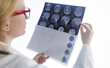 Epileptologist examines patient MRI and electroencephalogram. Concept treating epilepsy and helping...