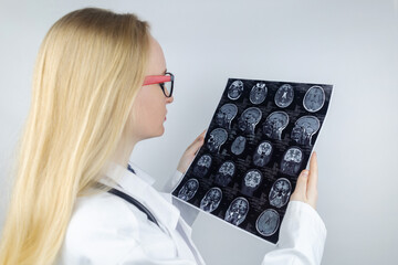 MRI of the brain. Neuropathologist holds a picture against the background of a light device to see...