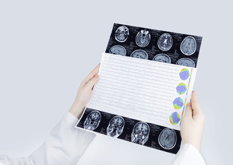 Epileptologist examines patient MRI and electroencephalogram. Concept treating epilepsy and helping...
