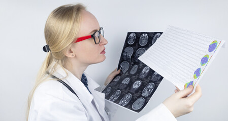 Epileptologist examines patient MRI and electroencephalogram. Concept treating epilepsy and helping...