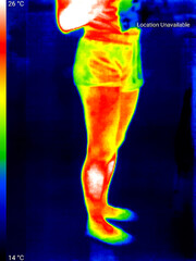 Thermographic photo of human body