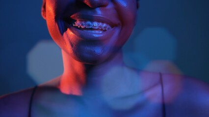 Happy smile. Orthodontic care. Dental correction. Neon blue red color closeup of woman mouth...