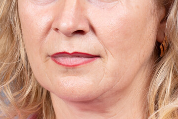 The lower part of the face and neck of an elderly woman with signs of skin aging. Age-related...
