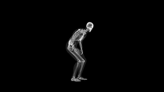 Human xray body and skeleton, stomack pain loop