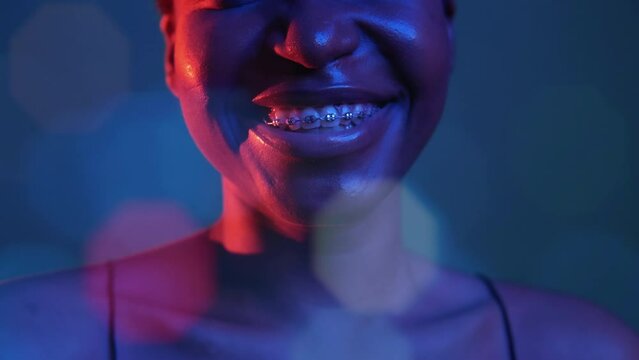 Happy smile. Orthodontic care. Dental correction. Neon blue red color closeup of woman mouth laughing with teeth braces in bokeh light isolated on dark.