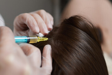 Plasma treatment, plasmolifting or PRP method point the introduction of the patient's own plasma...