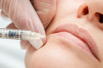Close up of hands of cosmetologist making botox injection in female lips. Lip shape correction, lip...
