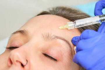 Mesotherapy with hyaluronic acid to a 40-year-old woman