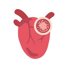 Heart with cholesterol flat illustration for health, medical, science, and education content