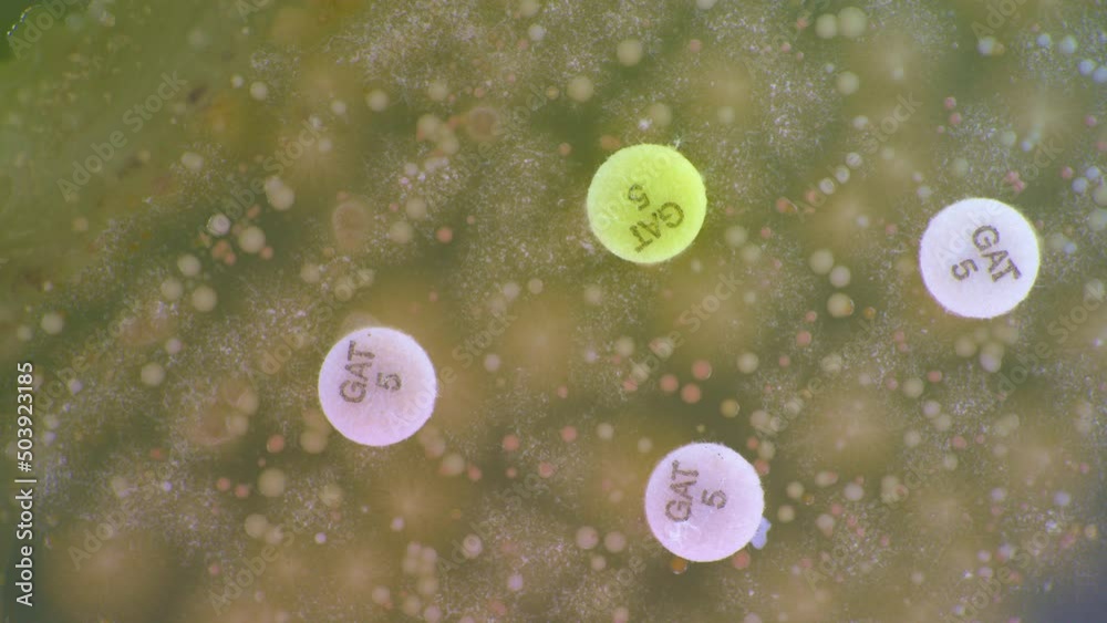 Sticker Demonstration of antibiotic resistance of bacteria to petri dishes. Petri dish time lapse