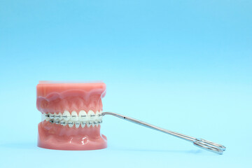 Model of the jaw with brackets on a blue background and a medical instrument. Place to copy. Close-up. Orthodontics. Correction of teeth. Dental center