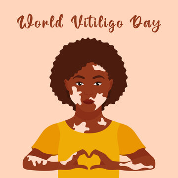 Portrait of dark-skinned girl with vitiligo making heart hands. Wolrd Vitiligo Day. June 25