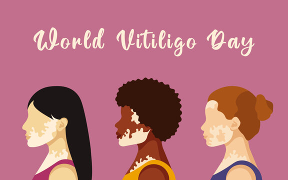 World Vitiligo Day. Group of women of different races