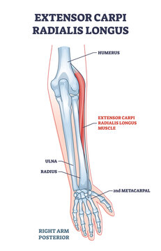 Extensor carpi radialis longus muscle with arm and hand bones outline diagram. Labeled educational fusiform muscular system in lateral part of posterior forearm vector illustration. Wrist movement.
