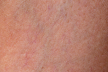 Close-up abstract close-up abstract pink tan human skin texture