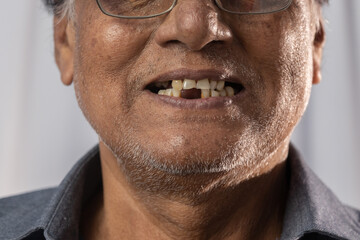 Dental problem