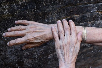 Aging hands of Asian woman. Concept of rheumatoid arthritis , osteoarthritis, wrist strain or joint pain.