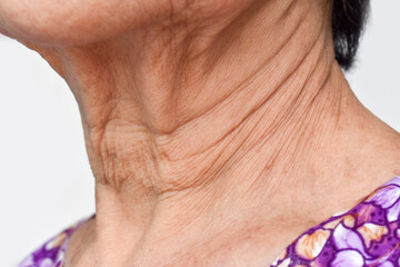 Aging skin folds or skin creases or wrinkles of Asian Chinese old woman.