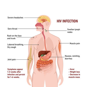 Signs and symptoms of HIV infection. Human silhouette with internal organs