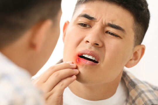 Asian man with cold sore looking at his reflection in mirror
