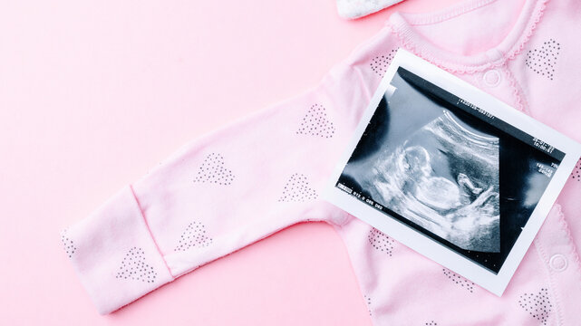 Ultrasound image pregnant baby photo. Fashion cute baby cloth with ultrasound pregnancy picture on pink background. Concept maternity, pregnancy, childbirth.