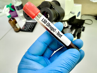 Doctor's hold Urine drug screen test sample, also known as a urine drug screening painless test it...