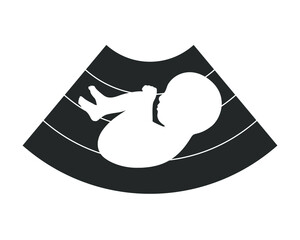 Fetus ultrasound graphic icon. Symbol ultrasound examination pregnancy. Sign isolated on white background. Vector illustration