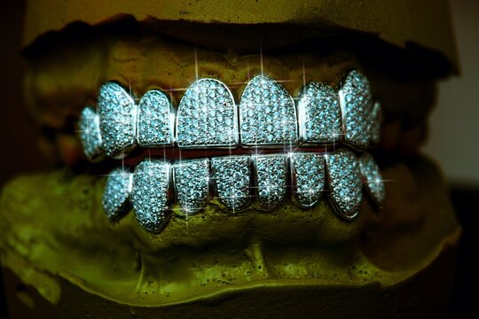 Grillz - Dental Jewelry
