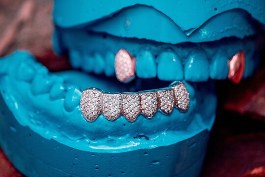 Grillz - Dental Jewelry