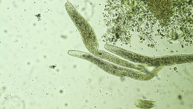 Micro organism ciliates, microscope magnification 20X