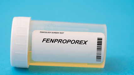 Fenproporex. Fenproporex toxicology screen urine tests for doping and drugs
